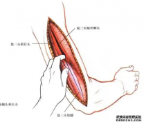 杏鑫网址肱三头肌肌腱位置在哪